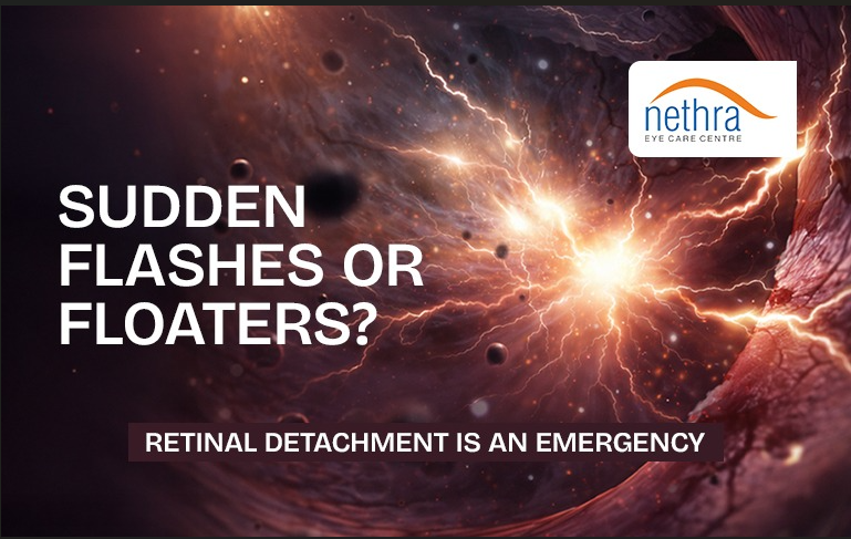 best eye hospital in kerela